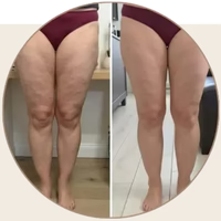 Genouillere Bambou Premium | Compression 3 Zones BambooFlex 360